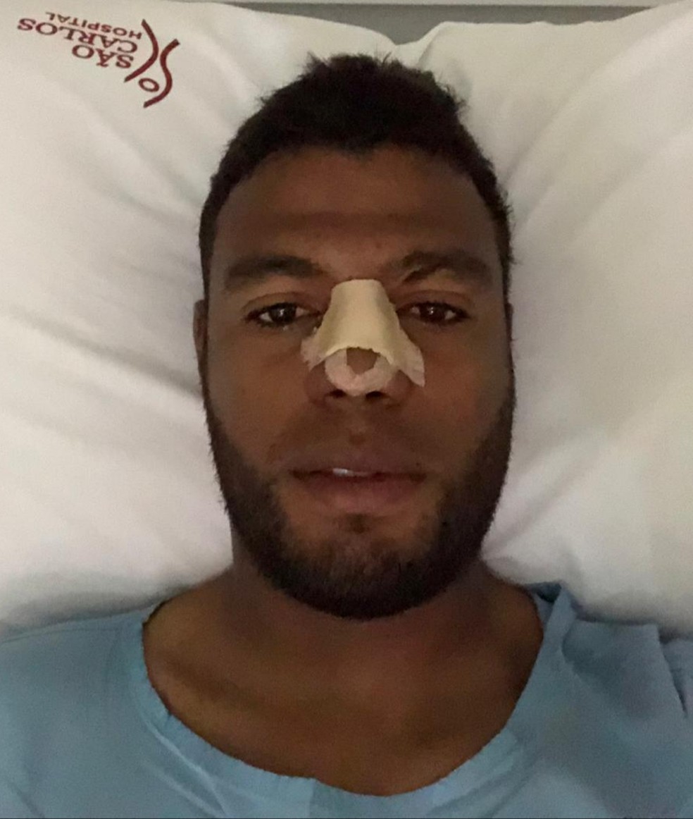 Com Nariz Quebrado Ha Dois Meses Auremir Passa Por Cirurgia E Mira Serie A Ceara Ge