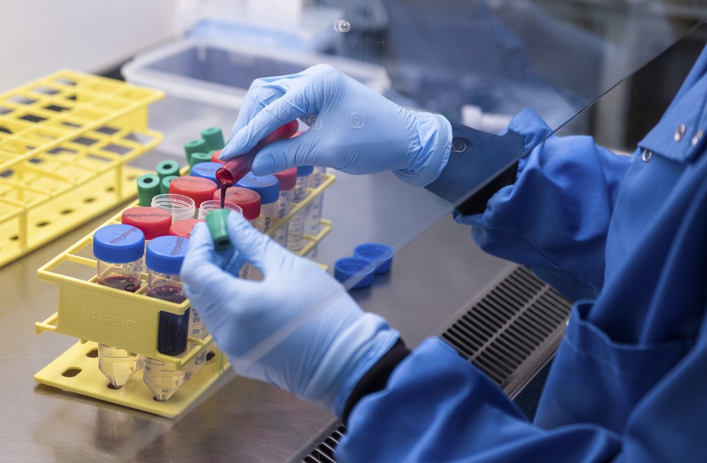 O excesso de coagulação no sangue pode causar trombose, infartos ou embolia pulmonar — Foto: John Cairns/University of Oxford via AP