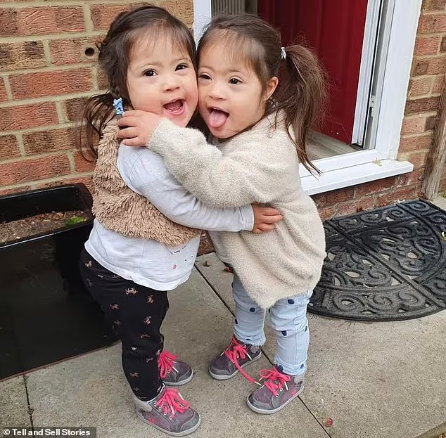 Gêmeas nascem com Síndrome de Down (Foto: Reprodução: Daily Mail )