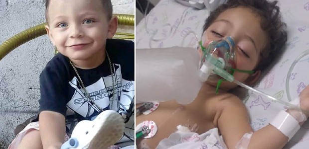 Pedro, que acabou de completar 2 anos, foi diagnostica com neuroblastoma em três locais: pulmão, pescoço e tórax (Foto: Arquivo pessoal)