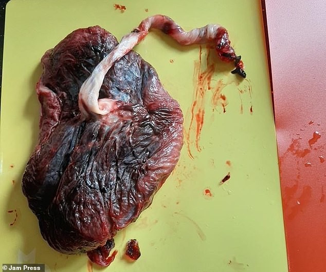 Britânica congelou sua placenta (Foto: Reprodução/Daily Mail)