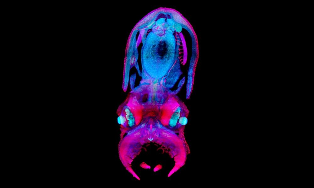 Imagens de microscopia de folha-luz de um polvo de 30 dias (Foto: Montserrat Coll Lladó, Jim Swoger/EMBL)