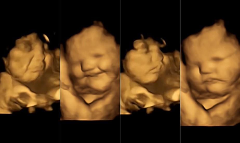 Bebês reagem a sabores de alimentos com expressões faciais ainda dentro da barriga, mostra estudo inédito com ultrassom 4D.