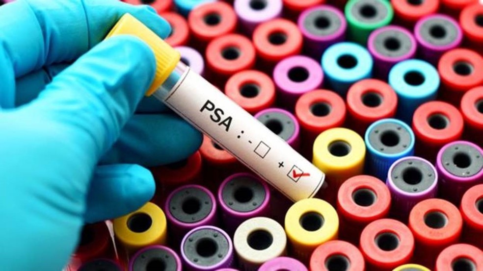 Exame de toque é realizado para diagnosticar o câncer de próstata — Foto: Getty Images via BBC
