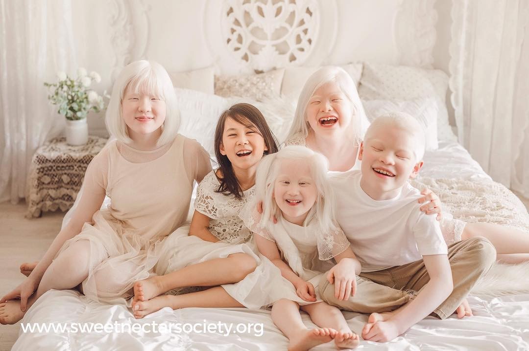 A família adotou cinco crianças, quatro são albinas e uma ter o nervo de um dos braços danificado (Foto: Reprodução/Instagram Sweet Nectar Society)