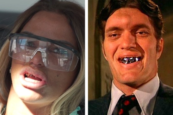 Katie Price comparou seu sorriso real ao do vilão Jaws, dos filmes do espião 007 (Foto: reprodução)