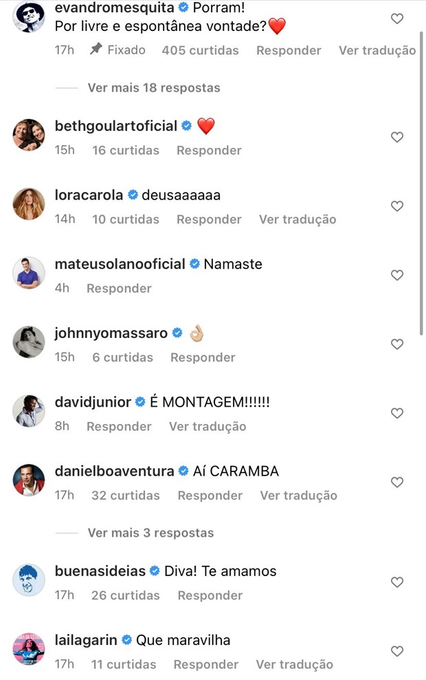 Famosos se impressionaram ao ver alongamento de Fernanda Torres (Foto: Reprodução / Instagram)