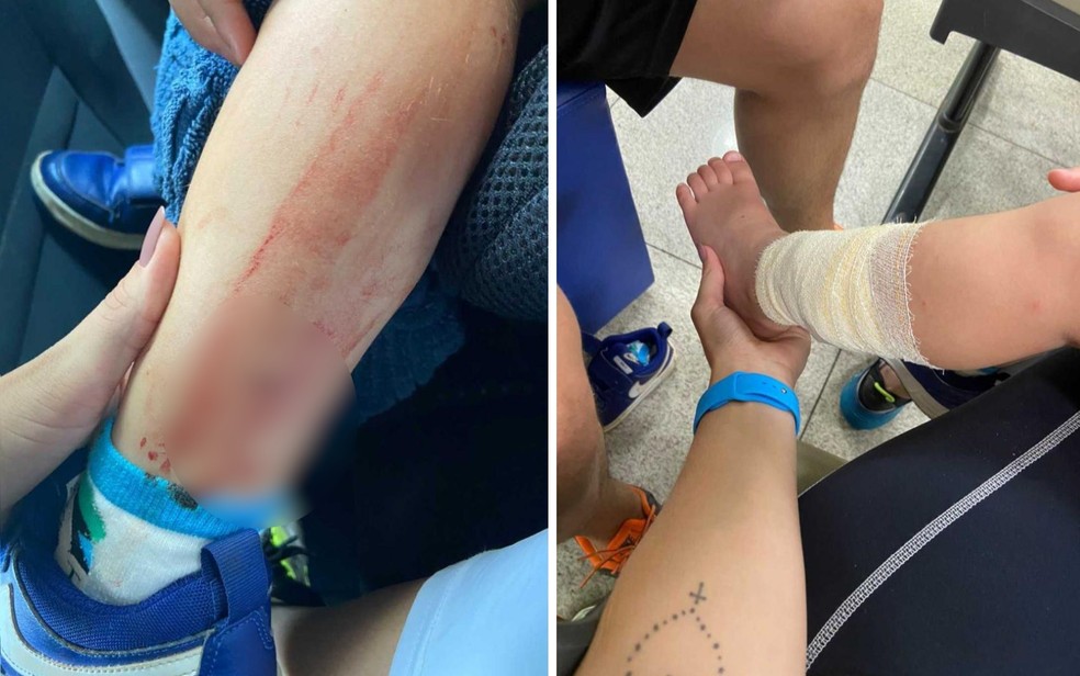 Menino de 3 anos é mordido por macaco no Parque Areião, em Goiânia, Goiás — Foto: Arquivo Pessoal/Vinicius Campos