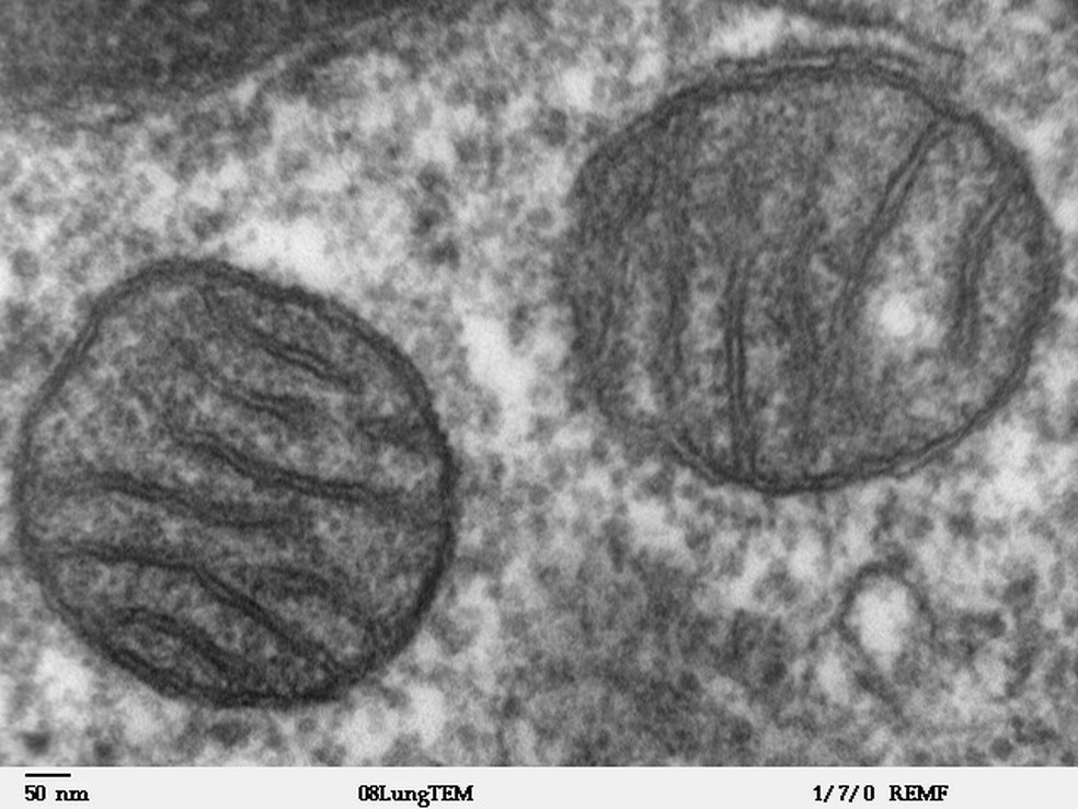 Imagem de microscópio eletrônico mostra duas mitocôndrias presentes em tecido pulmonar de mamífero. Disfunções nessa estrutura presentes nas células podem estar associadas ao Alzheimer  (Foto: Domínio público)