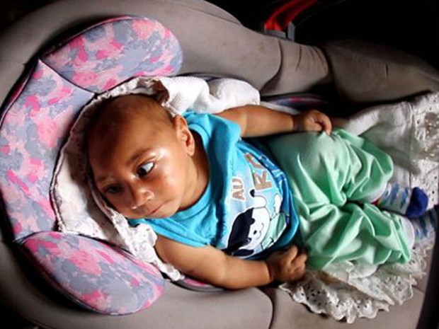 Bebê só teve a microcefalia descoberta 2 meses após nascer. Hoje, aos 4 meses, ainda aguarda a fisioterapia (Foto: Da BBC)