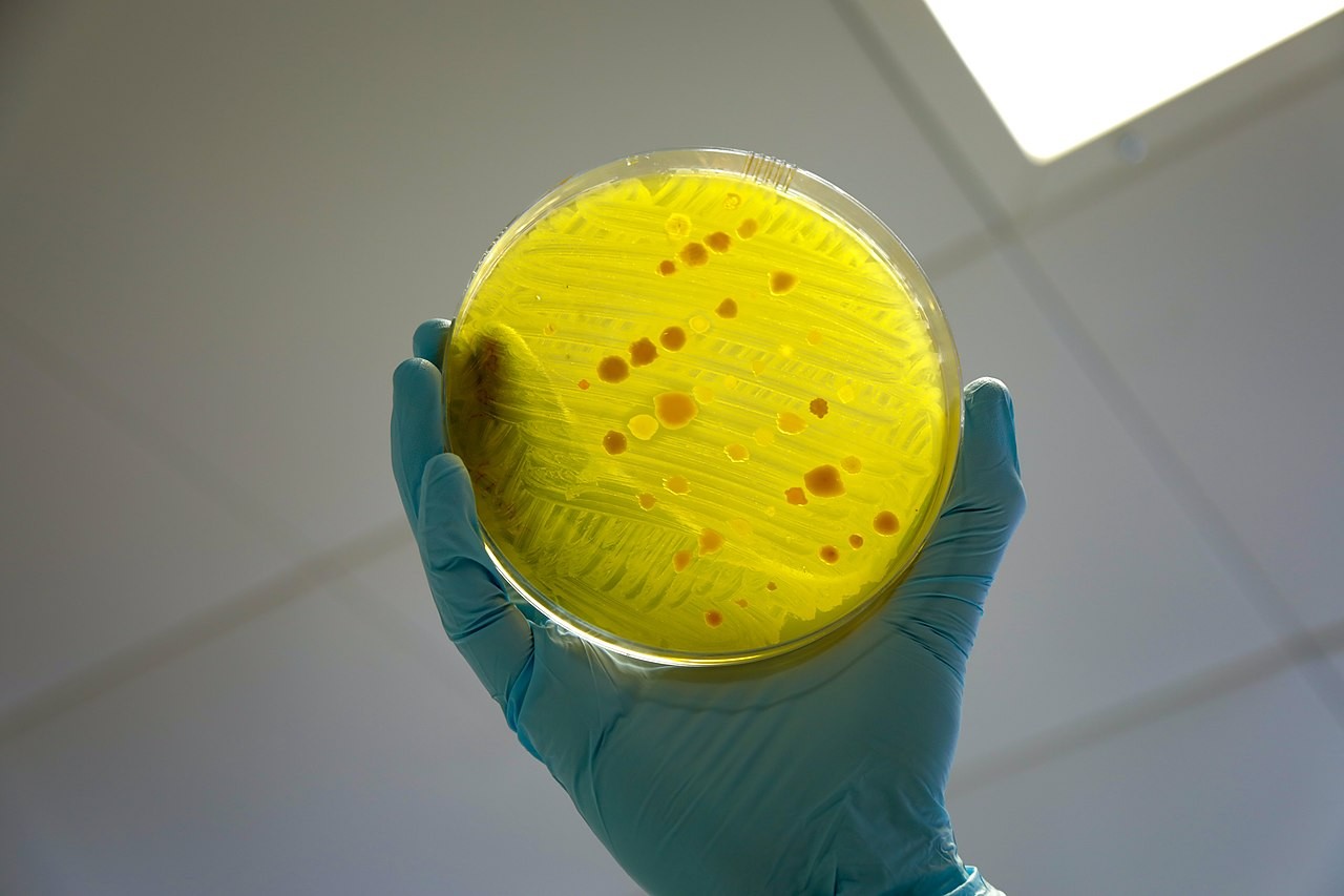 Bactérias multirresistentes já são um problema global de saúde pública (Foto: DFID/ Will Crowne)