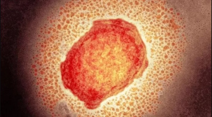 Partícula do vírus da varíola dos macacos; primeiro caso foi confirmado no Brasil (Foto: Science Photo Library via BBC)