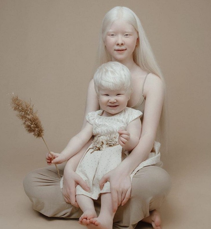 Irmãs albinas têm 12 anos de diferença (Foto: Reprodução: Instagram)