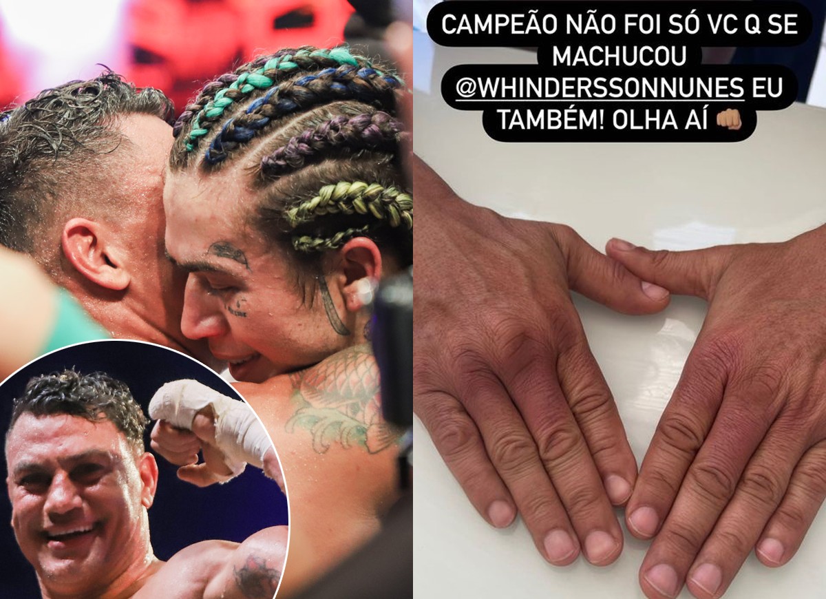 As mãos de Popó após a luta com Whindersson Nunes (Foto: Brazil News e Reprodução Instagram)
