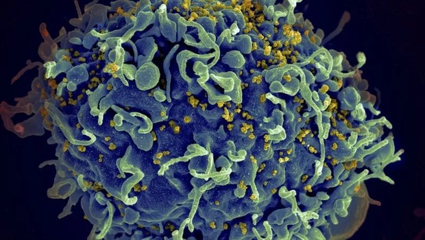 Eletromicrografia mostra HIV infectando célula humana; variante VB levou a maior carga viral em pacientes ainda sem tratamento (Foto: Getty Images via BBC)