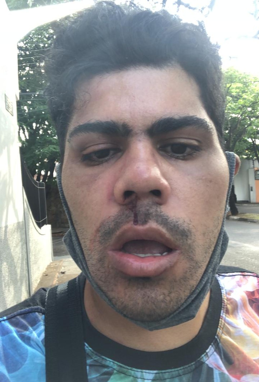 Vítima alega ter sido agredida em um banheiro público do Parque do Povo — Foto: Rafael Gomes