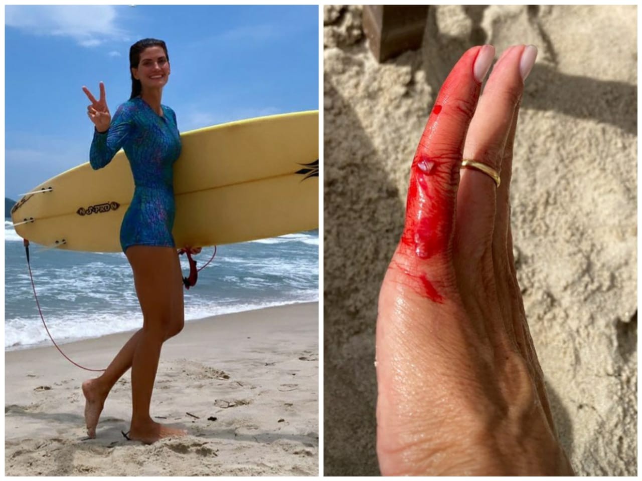 Isabella Fiorentino mostra machucado após surfar (Foto: Reprodução/Instagram)