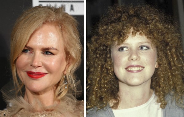 A atriz Nicole Kidman: ates e depois (Foto: Getty)