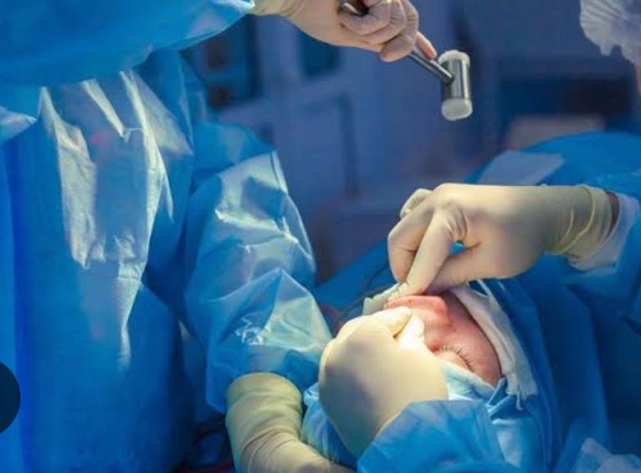 Cirurgião plástico é condenado por deixar nariz torto de  paciente