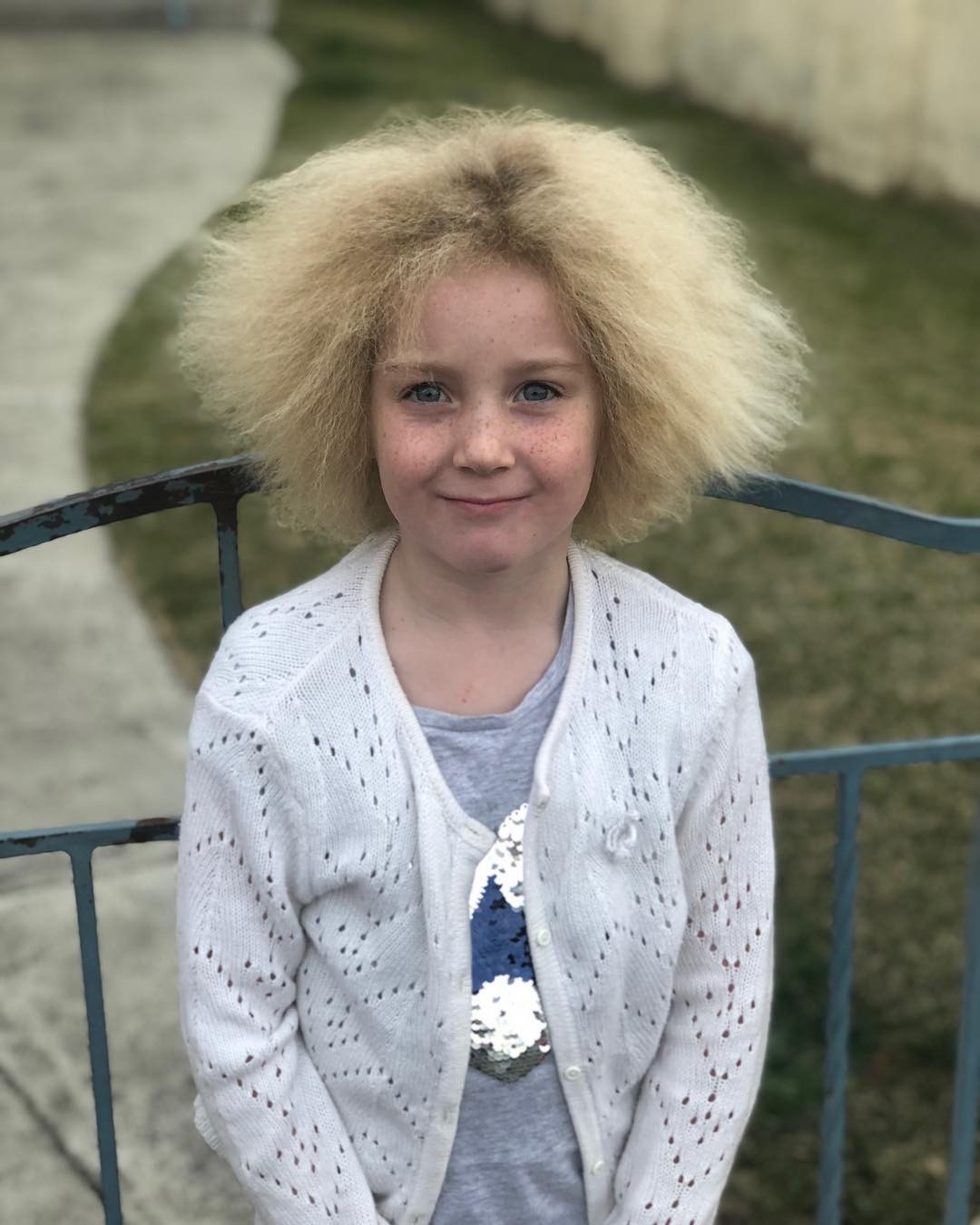 Menina com condição genética rara a faz ter o cabelo do Einstein (Foto: Reprodução/Instagram)