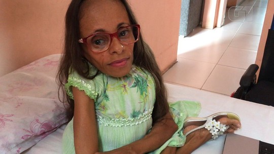 Com 'ossos de vidro', baiana se forma e busca apoio para publicar livro