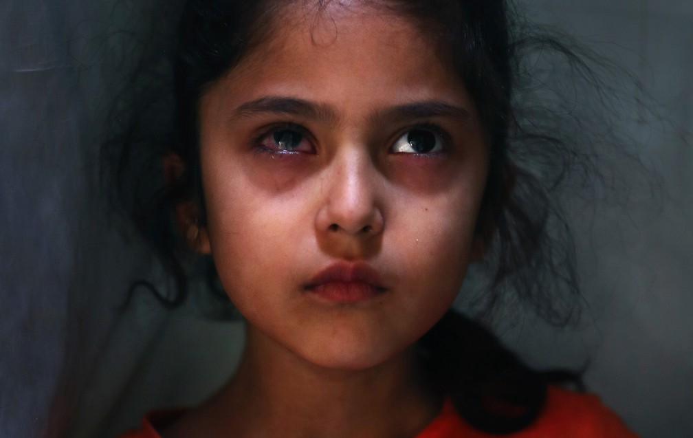 17 de setembro - Muneefa Nazir, de seis anos, é vista do lado de fora de sua casa em Srinagar, na Caxemira controlada pela Índia, após ser atingida em seu olho direito por uma bola de gude disparada por soldados paramilitares indianos  — Foto: Mukhtar Khan/AP