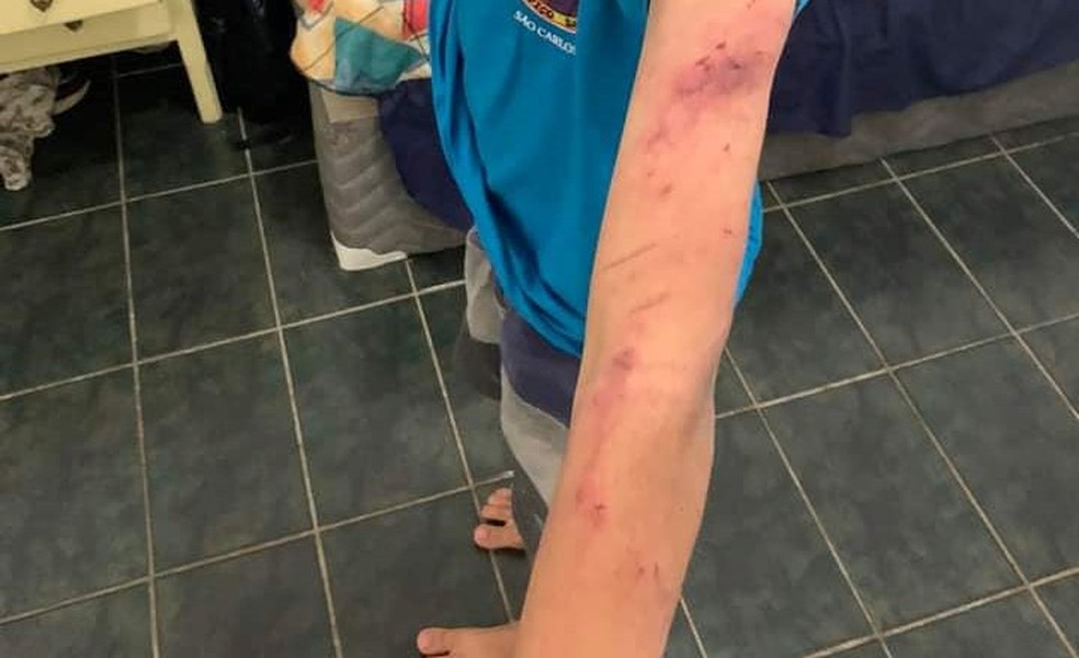Criança fica machucada depois de ser espancada pela própria mãe em São Carlos — Foto: Arquivo Pessoal