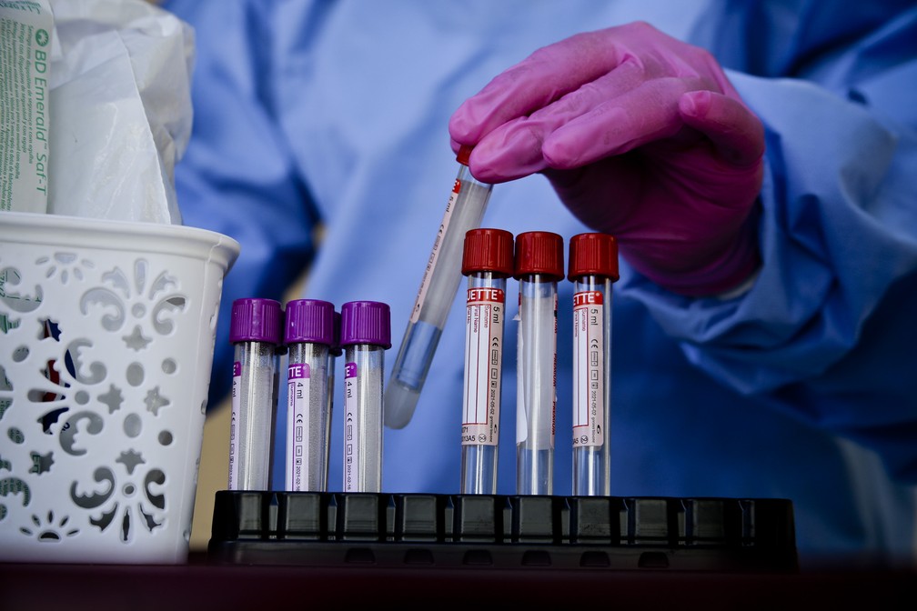 Material de realização de teste RT-PCR, que detecta o novo coronavírus — Foto: Breno Esaki/Agência Saúde