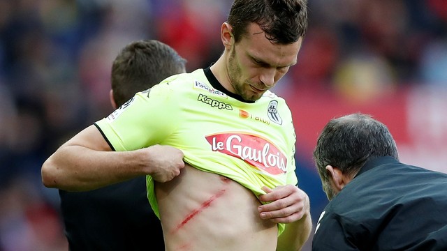 Como ficou o jogador do Angers após dividida com Thiago Motta (Foto: Reuters)