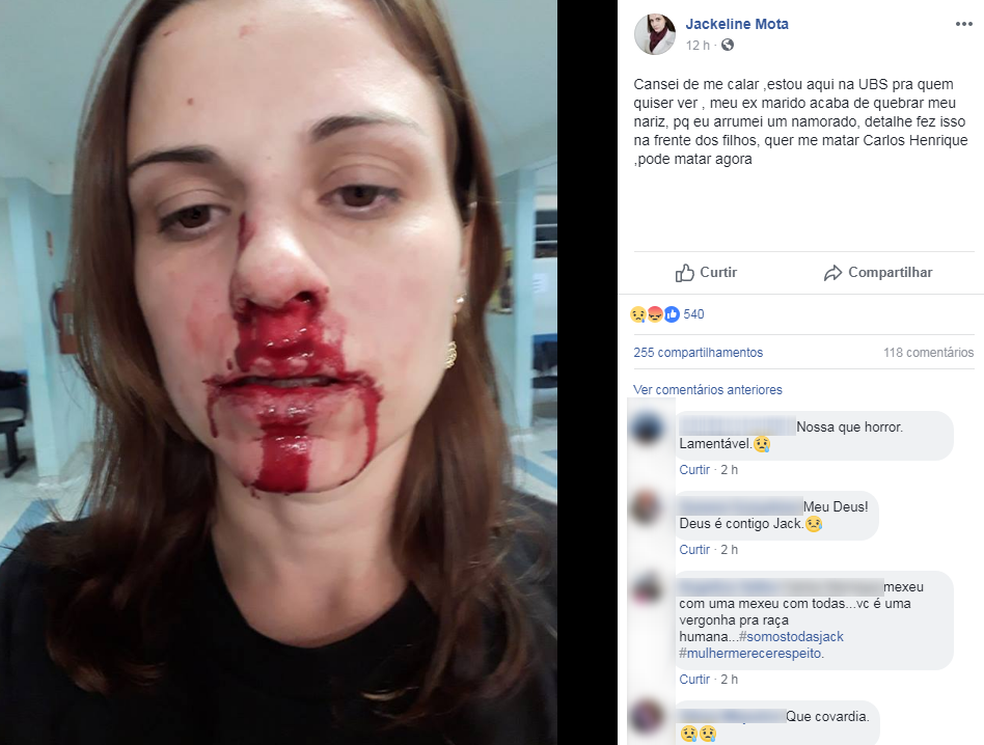Mulher teve uma fratura no nariz apÃ³s ser agredida pelo ex-marido em AraÃ§ariguama (SP) (Foto: Facebook/ReproduÃ§Ã£o)
