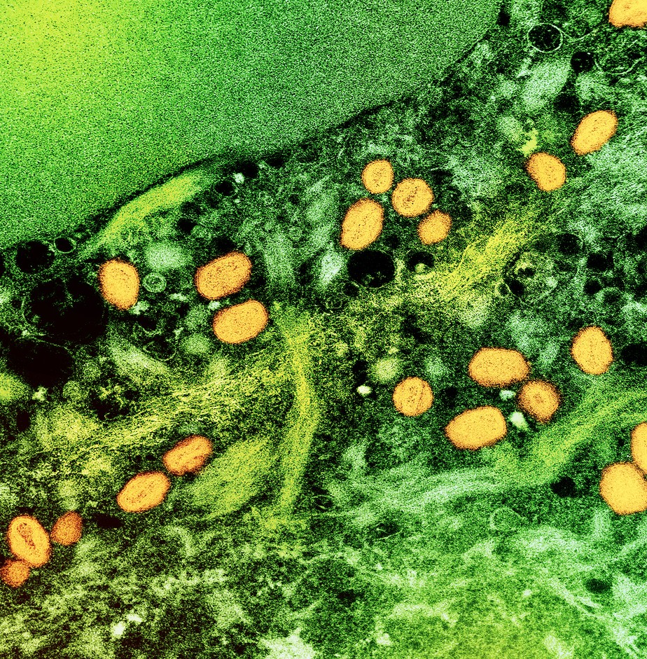 Micrografia eletrônica de transmissão colorida de partículas do vírus da varíola dos macacos (amarelo) encontradas dentro de uma célula infectada (verde), cultivadas em laboratório.