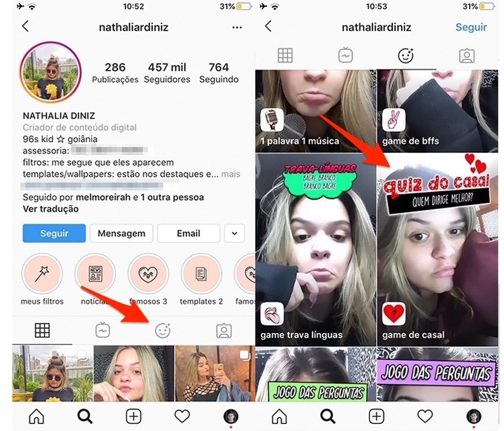 Como Fazer O Quiz De Casal No Instagram Redes Sociais Techtudo