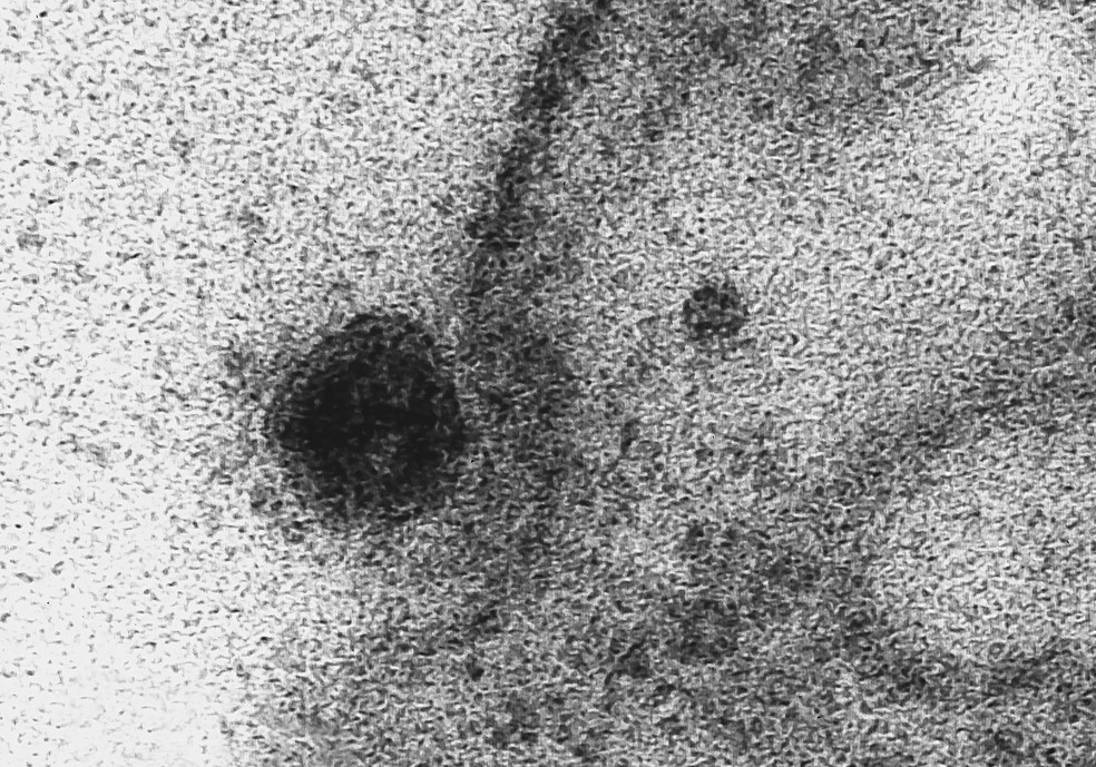 Imagem de microscopia mostra à esquerda o Sars-Cov-2, o novo coronavírus, atacando a membrana de uma célula. Esfera escura à esquerda — Foto: IOC/Fiocruz