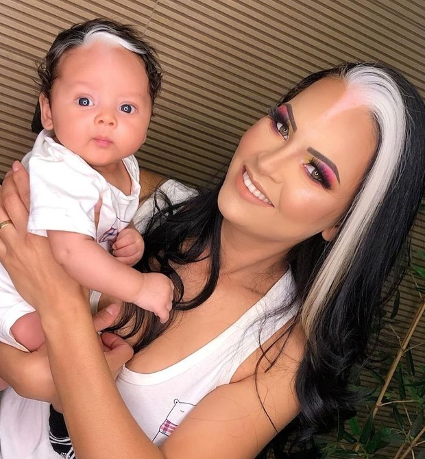Piebaldismo: mãe e filho têm a mesma mecha branca nos cabelos (Foto: Reprodução/Instagram)