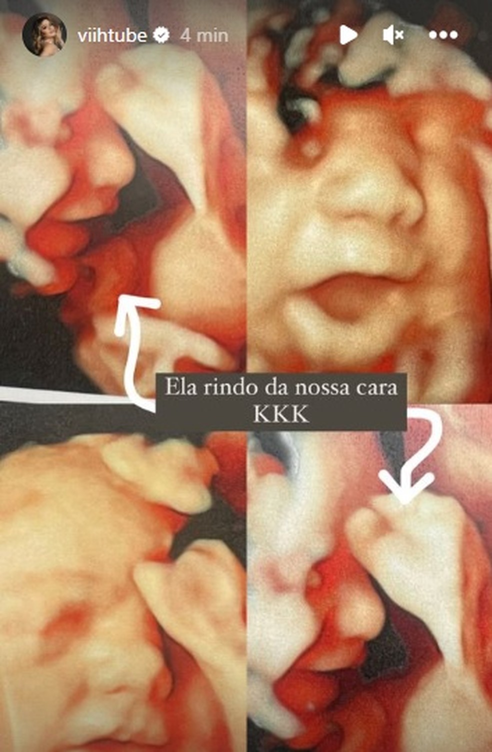 Viih Tube mostra rosto da filha durante ultrassom 