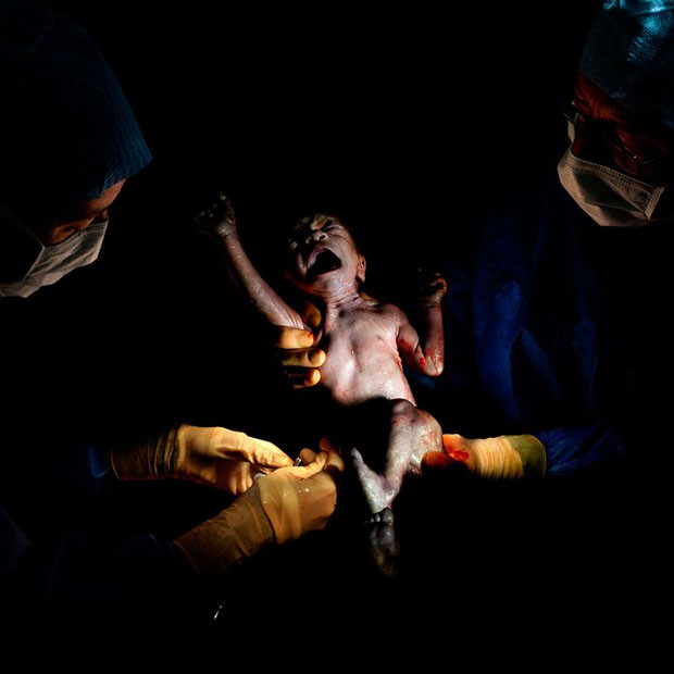 Os primeiros instantes de vida de um bebê (Foto: Christian Berthelot / divulgaç)