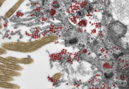 Pesquisadores encontram partículas intactas de SARS-CoV-2 na mucosa olfatória (Foto: Reprodução/Charité)