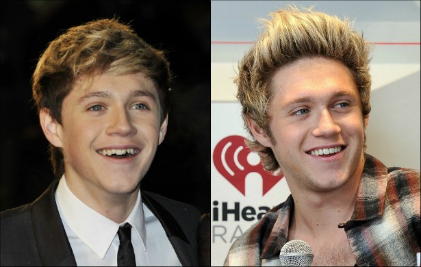 Falando em boyband, Niall Horan, do grupo britânico One Direction, é outro que recorreu a um bom profissional da odontologia para aprimorar seu sorriso. Melhorou bastante, não? (Foto: Getty Images)