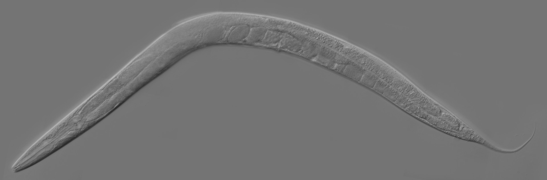 Uma Caenorhabditis elegans (Foto: Wikimedia Commons)