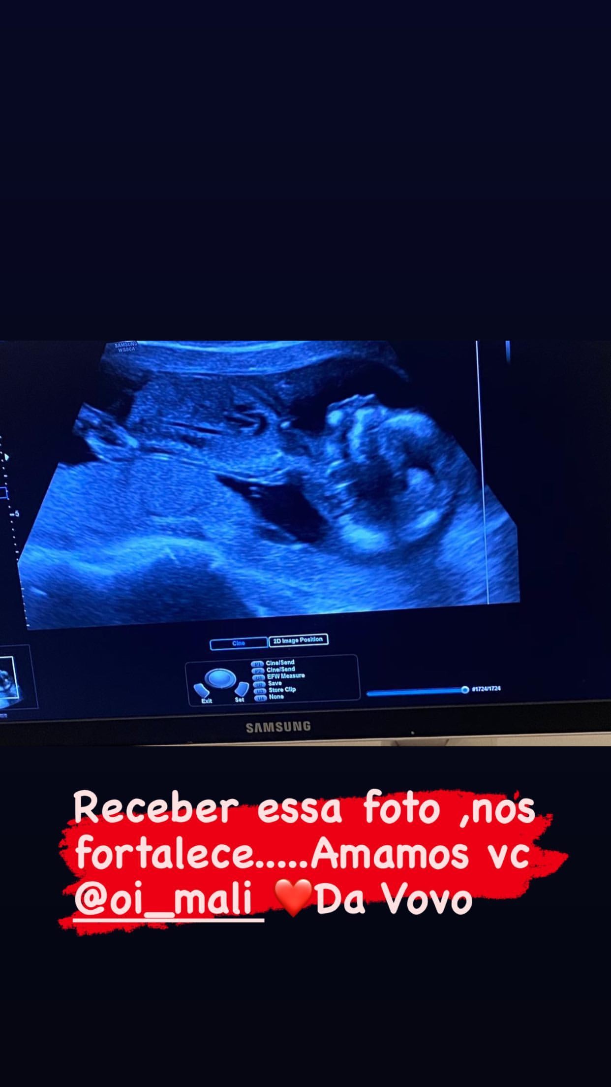 Poiliana Rocha posta em isolamento (Foto: Reprodução/Instagram)