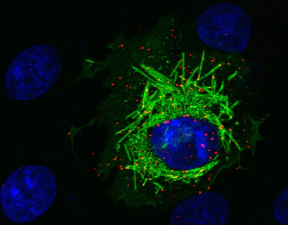 Em vermelho, proteína humana PCNA migra do núcleo da célula (em azul) para o citoplasma na presença da proteína M (verde) — Foto: Orlando B. Scudero/ ICB-USP
