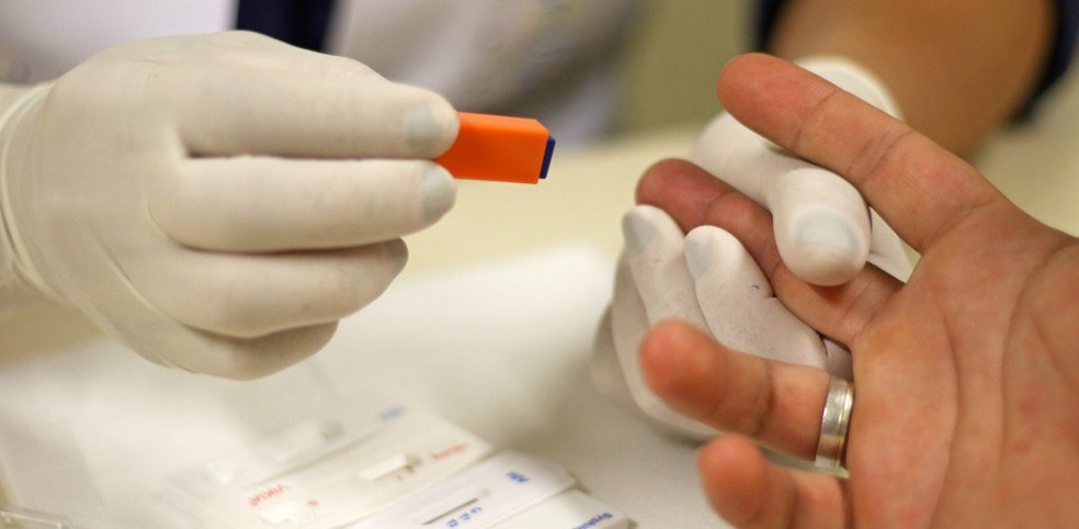 Acre tem mais de 1,3 mil pacientes em tratamento contra o HIV  â€” Foto: MinistÃ©rio da SaÃºde/DivulgaÃ§Ã£o