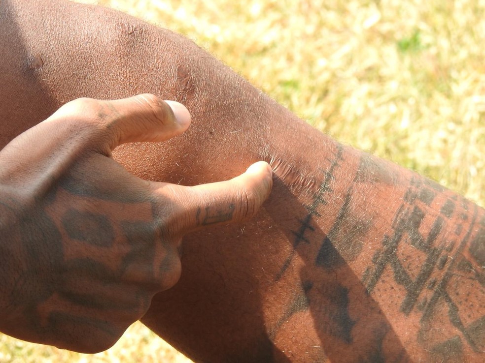 Renê Júnior, volante do Corinthians, mostra cicatriz no joelho esquerdo — Foto: Marcelo Braga