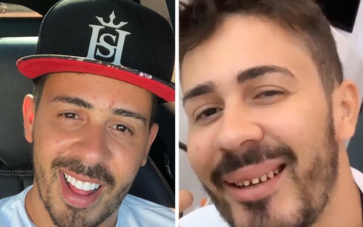 Carlinhos Maia mostra sorriso natural durante manutenção ...