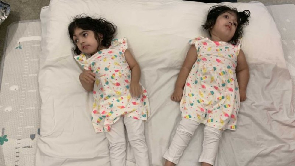 Safa e Marwa tiveram alta do hospital cinco meses após a cirurgia, mas continuaram morando em Londres por um tempo — Foto: BBC