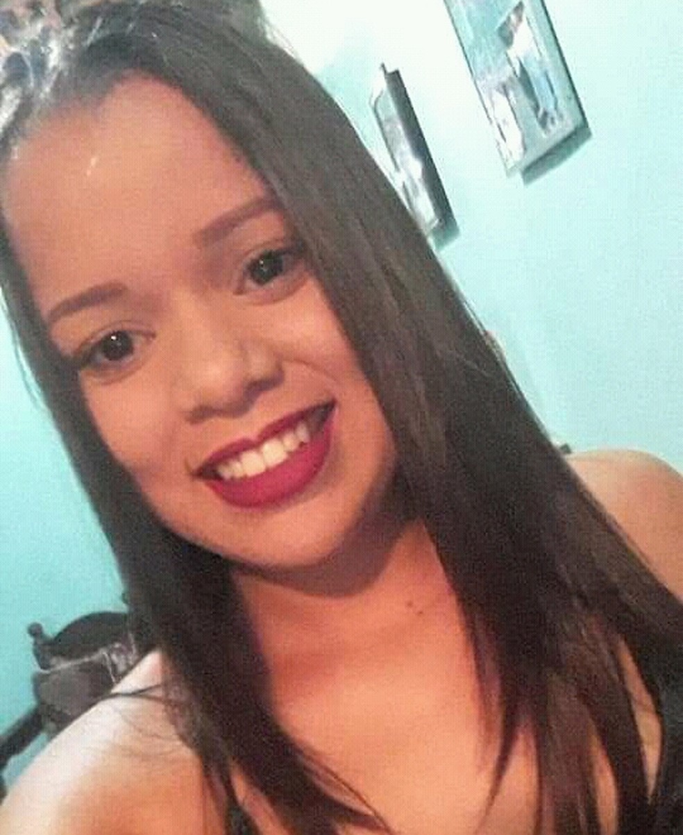 Mayara Estefanny teve rosto queimado pelo ex-marido, no Recife  â€” Foto: ReproduÃ§Ã£o/TV Globo 