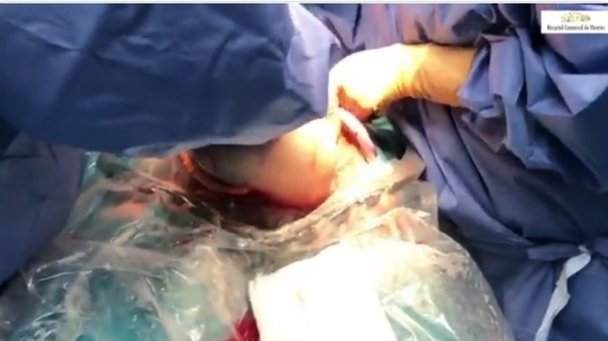 España.  Video muestra raro nacimiento de bebé en mayúsculas |  modo de vida