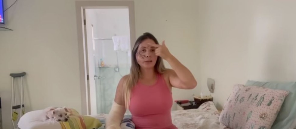Caminhoneira Aline mostra o rosto pela primeira vez após o acidente  — Foto: Redes Sociais/ Reprodução 