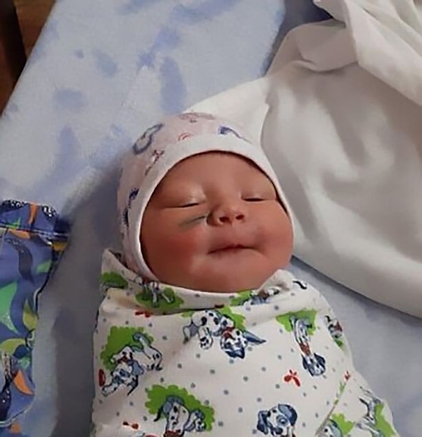 O bebê teve o rosto cortado durante a cesárea (Foto: Reprodução/Instagram)