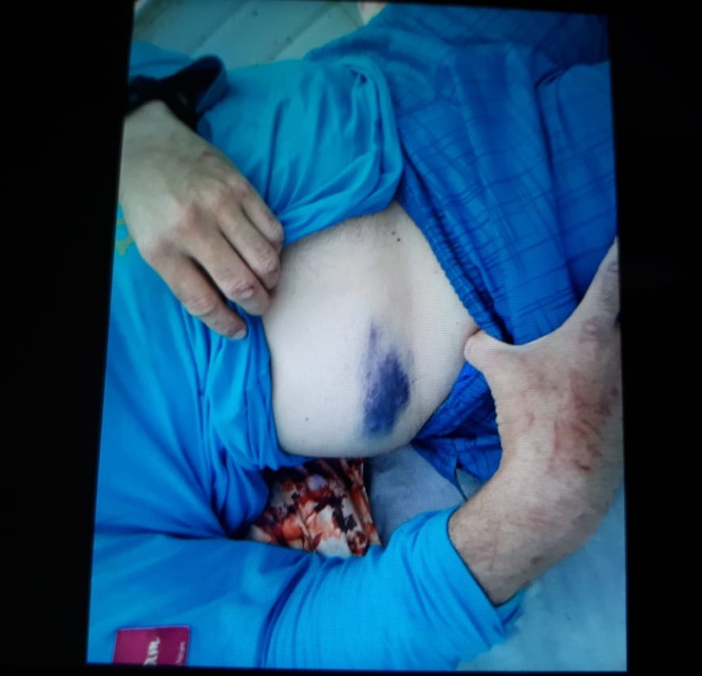 Piloto foi resgatado com vida por moradores de comunidade próxima ao acidente e levado para pronto-socorro de Coari — Foto: Divulgação/PM